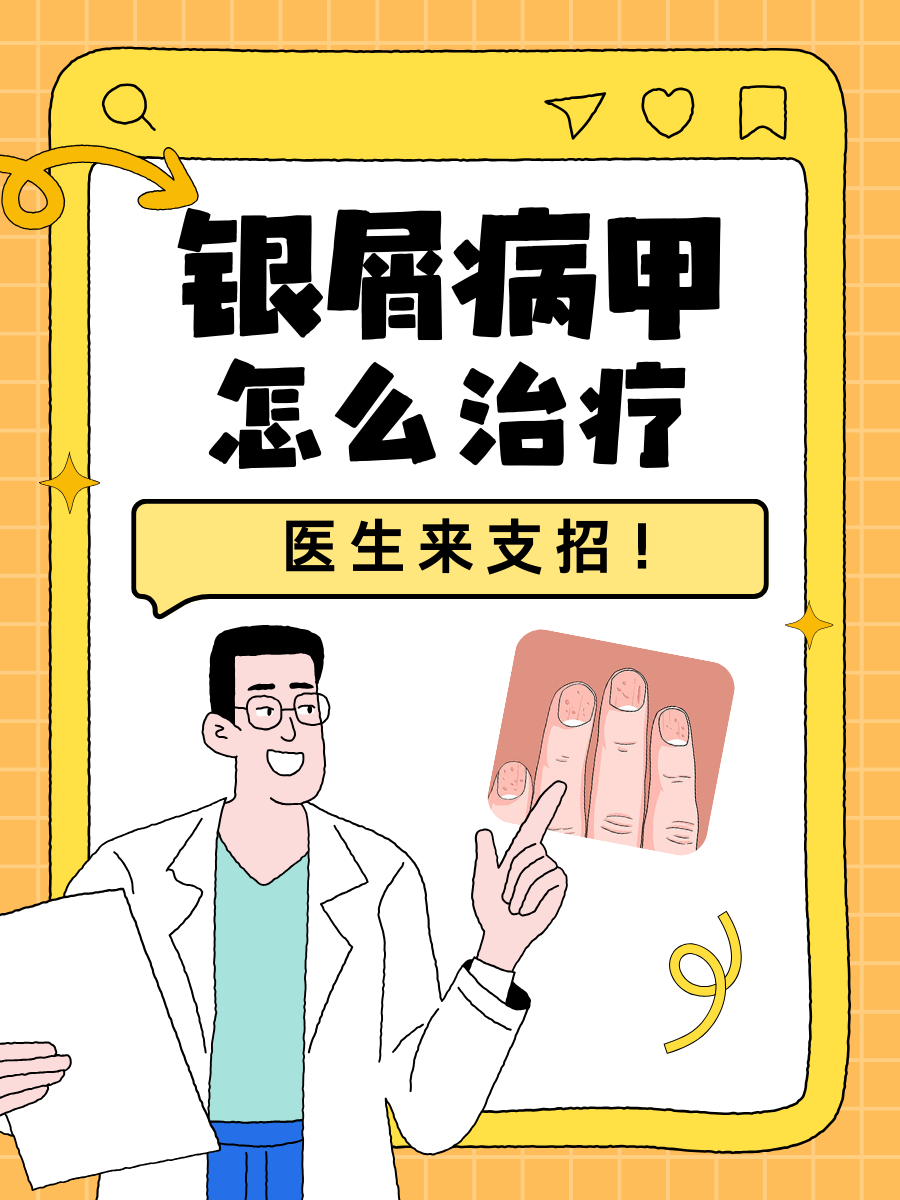 银屑病甲怎么治疗，医生来支招！