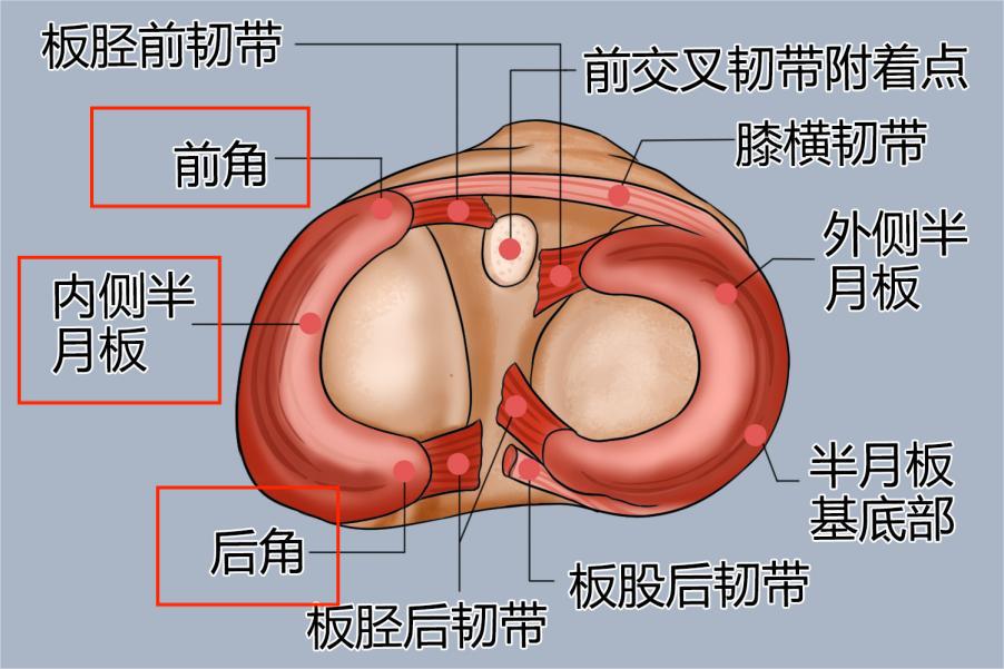 内侧半月板疼痛位置示意图
