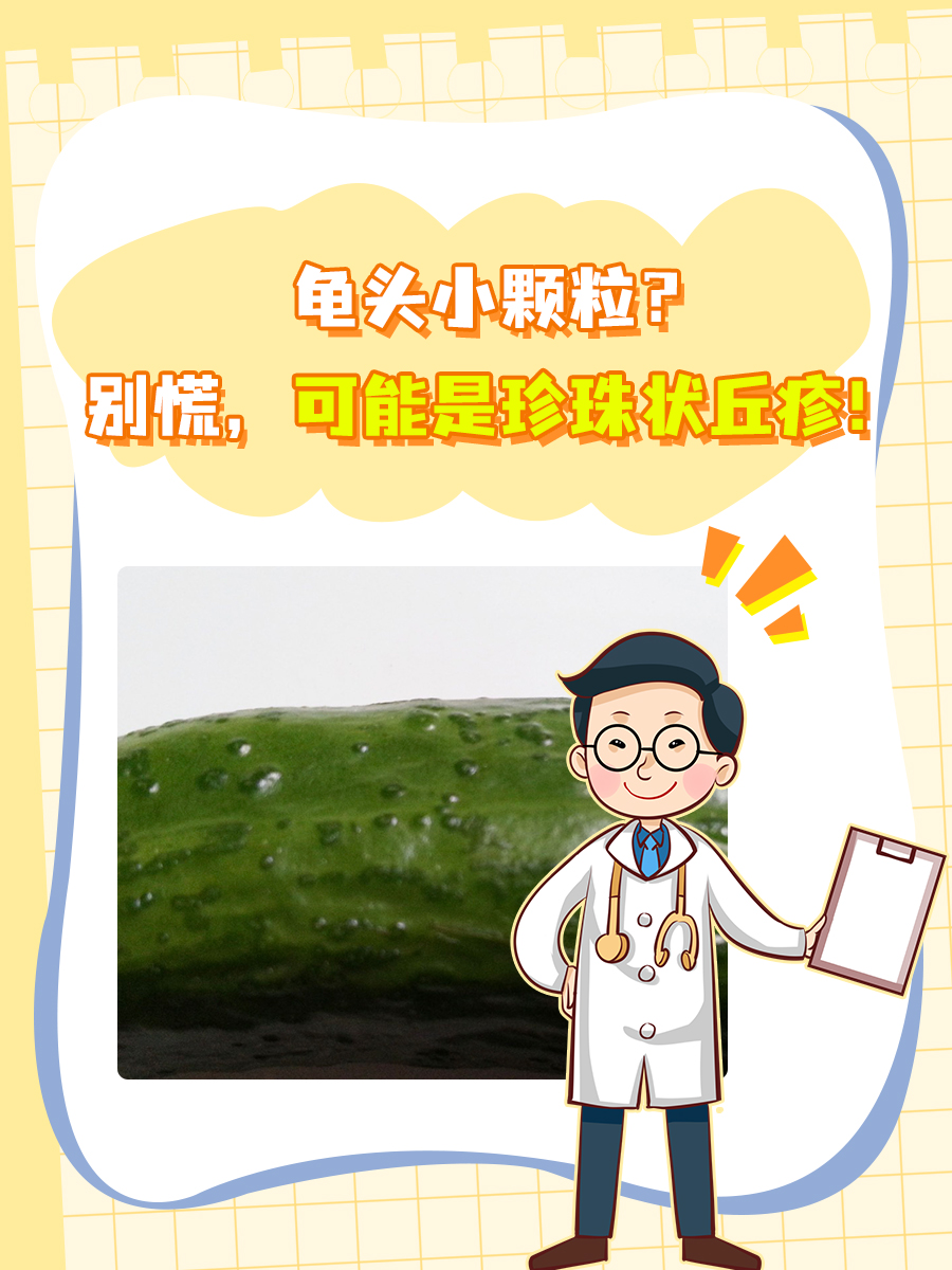 龟头小颗粒？别慌，可能是珍珠状丘疹！