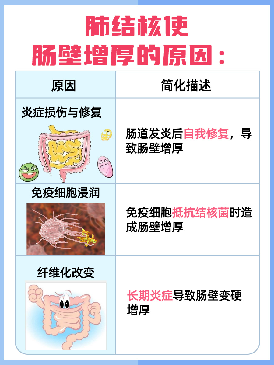 不懂就问：肺结核会使肠壁增厚吗？