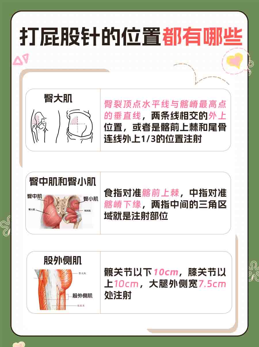 医生分享：一文看懂屁股针位置怎么定位？