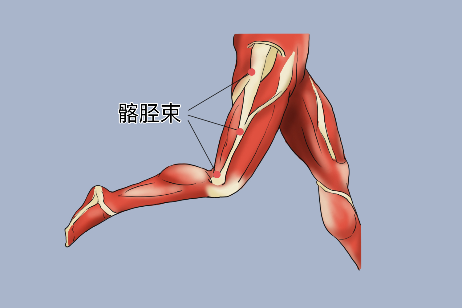 髂胫束损伤痛点图