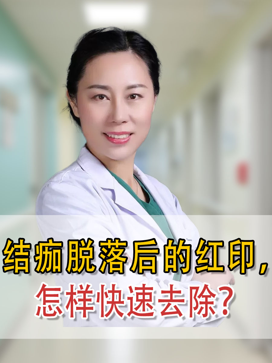 结痂脱落后的红印，怎样快速去除？