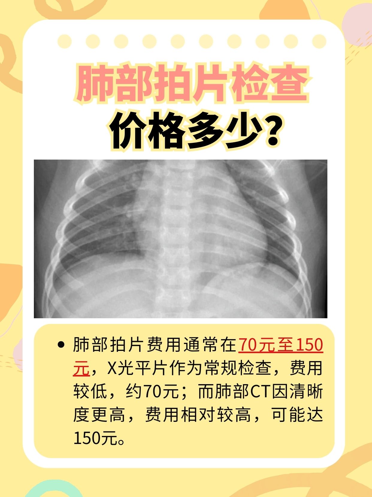 医生告诉你：拍个肺部片子要多少钱？