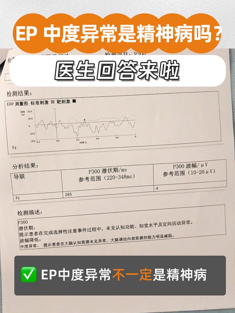 EP中度异常是精神病吗?医生回答来啦