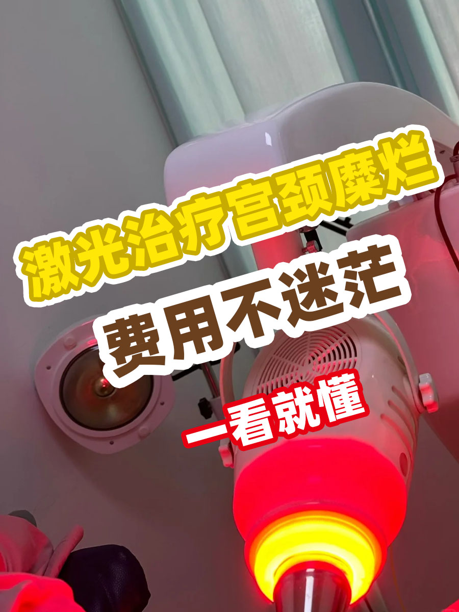 激光治疗宫颈糜烂，费用不迷茫，一看就懂