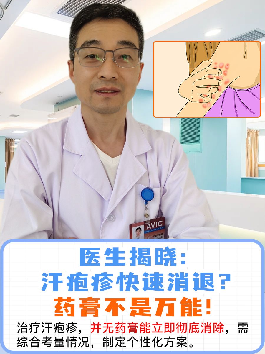 医生揭晓：汗疱疹快速消退？药膏不是万能！