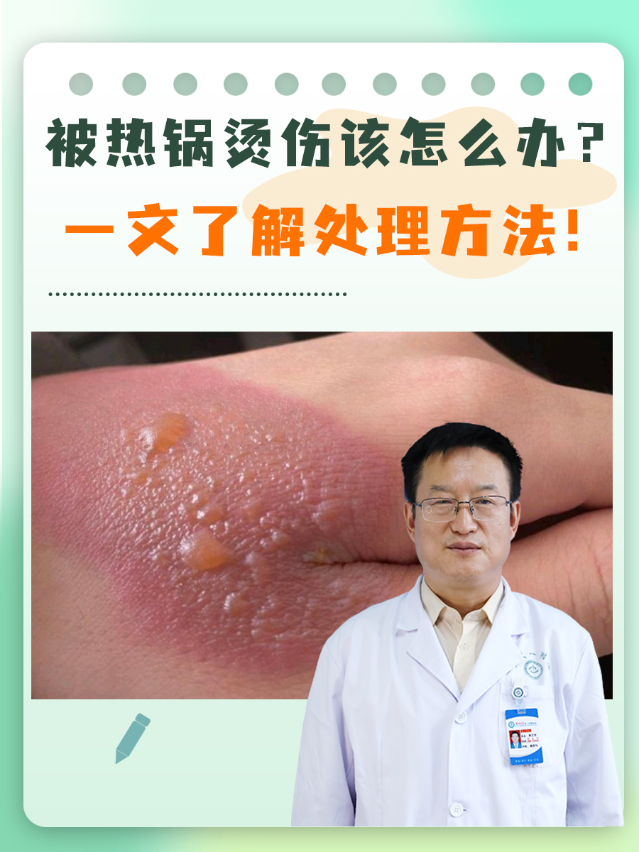 被热锅烫伤该怎么办？一文了解处理方法！