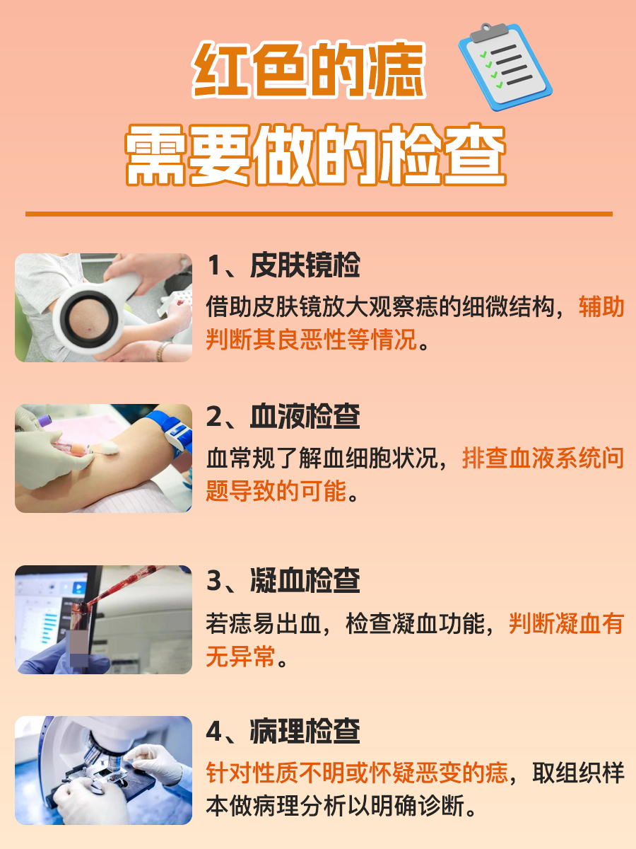 医生解答:红色的痣怎么回事