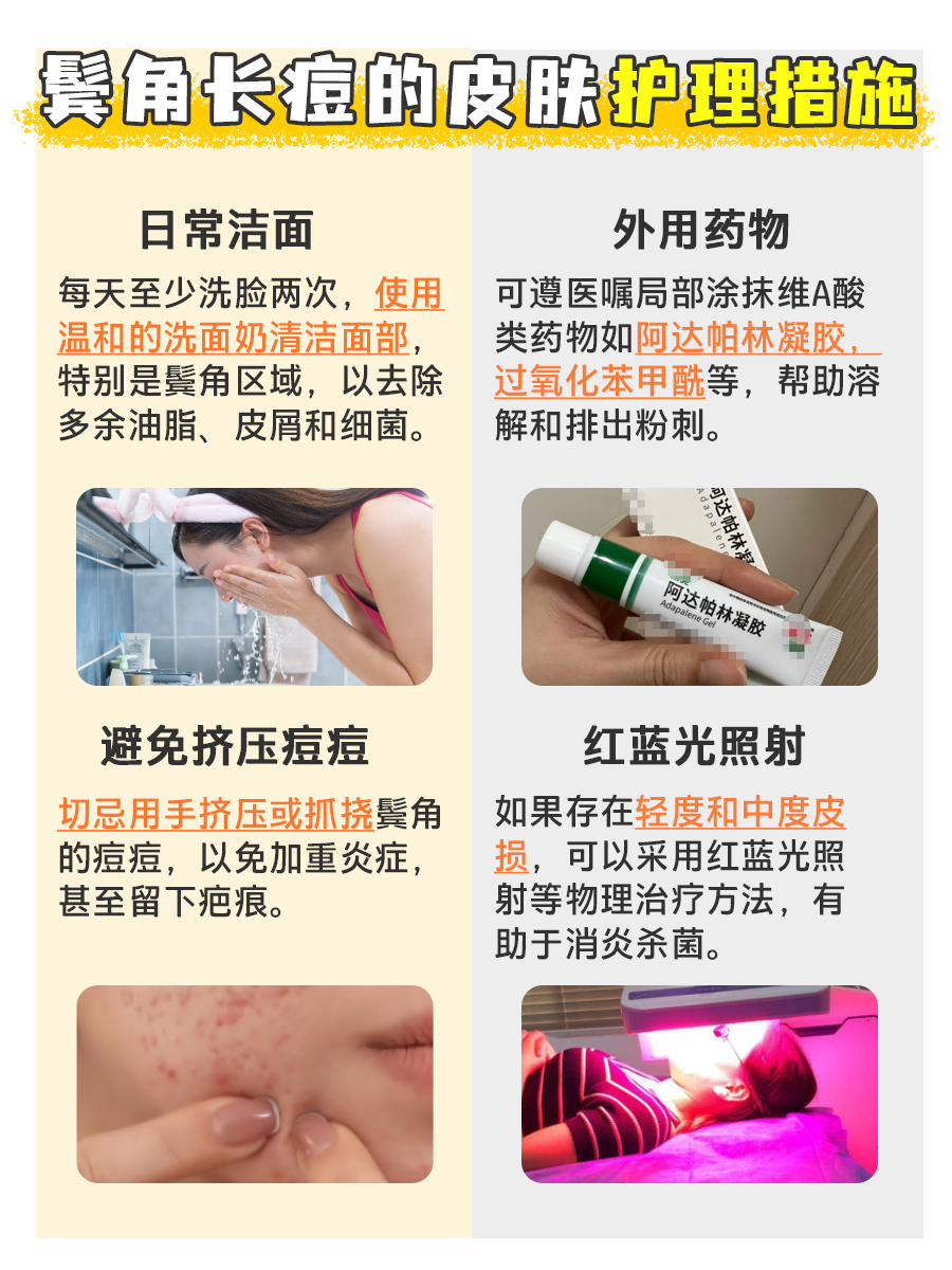 鬓角长痘的幕后黑手,你知道吗?