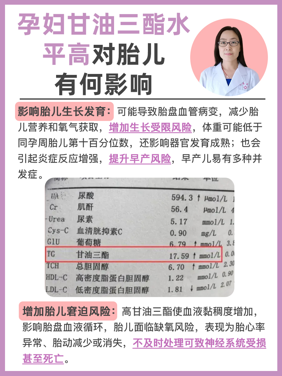 孕妇甘油三酯水平高对胎儿有何影响