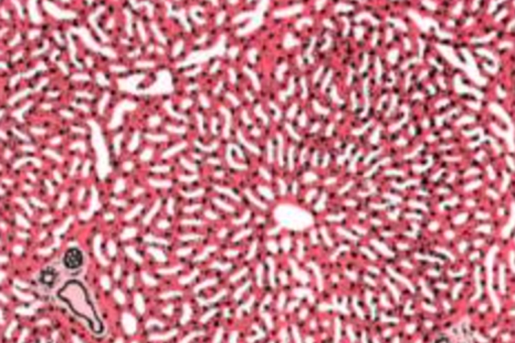 肝小叶结构图 肝小叶结构图