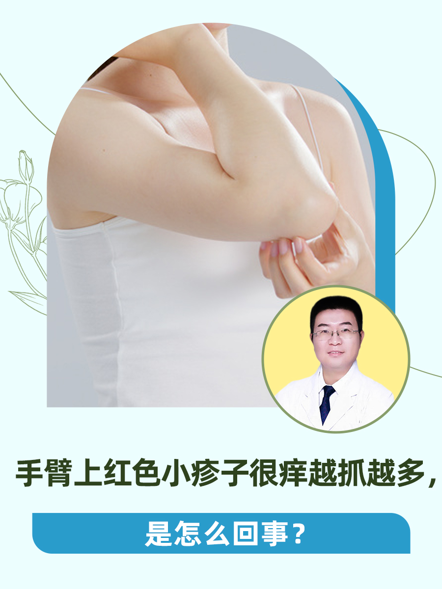 手臂上红色小疹子很痒越抓越多,是怎么回事?