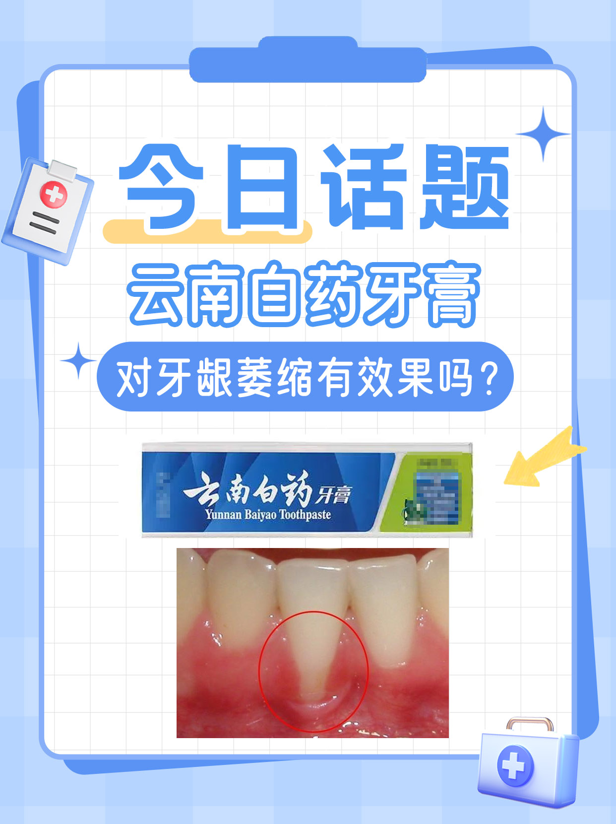 今日话题——云南白药牙膏对牙龈萎缩有效果吗?
