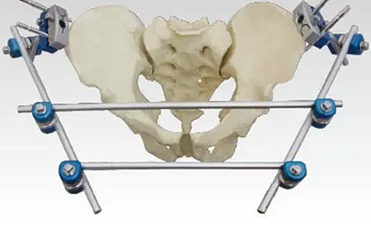 骨盆外固定支架图 骨盆外固定支架图
