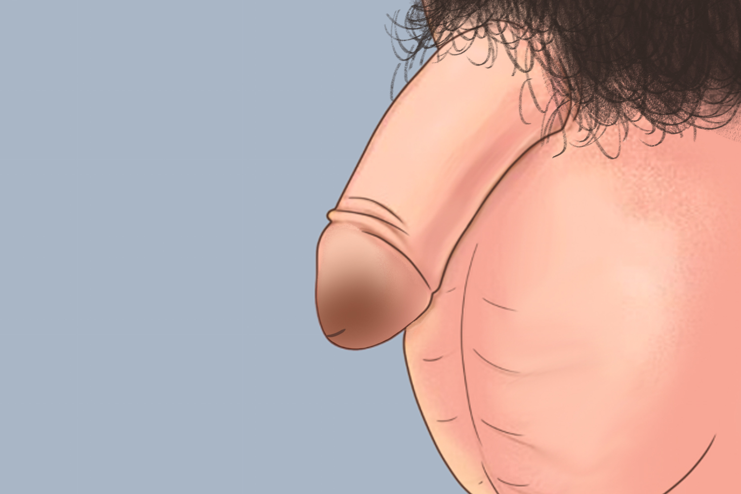 浆细胞性龟头炎色素沉着图