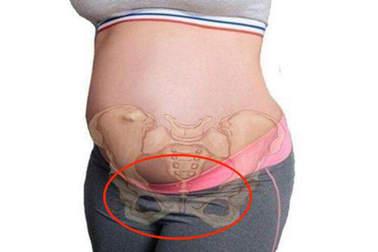 孕妇耻骨疼痛部位图