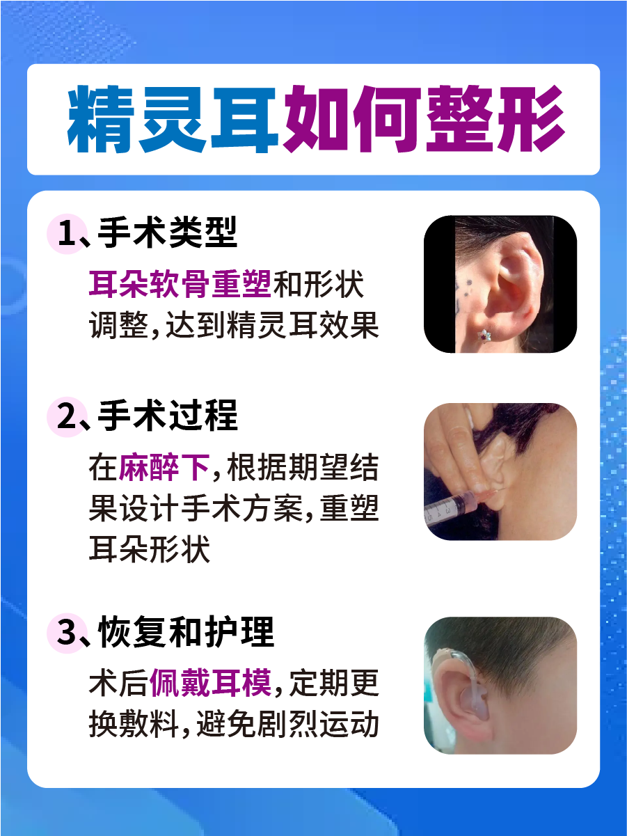 一文了解精灵耳：是如何进行整形的？