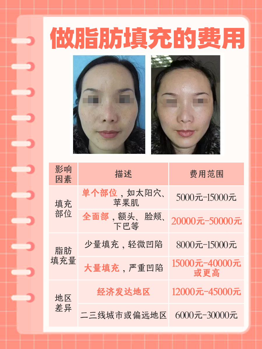 做脂肪填充大概多少钱，一文解析