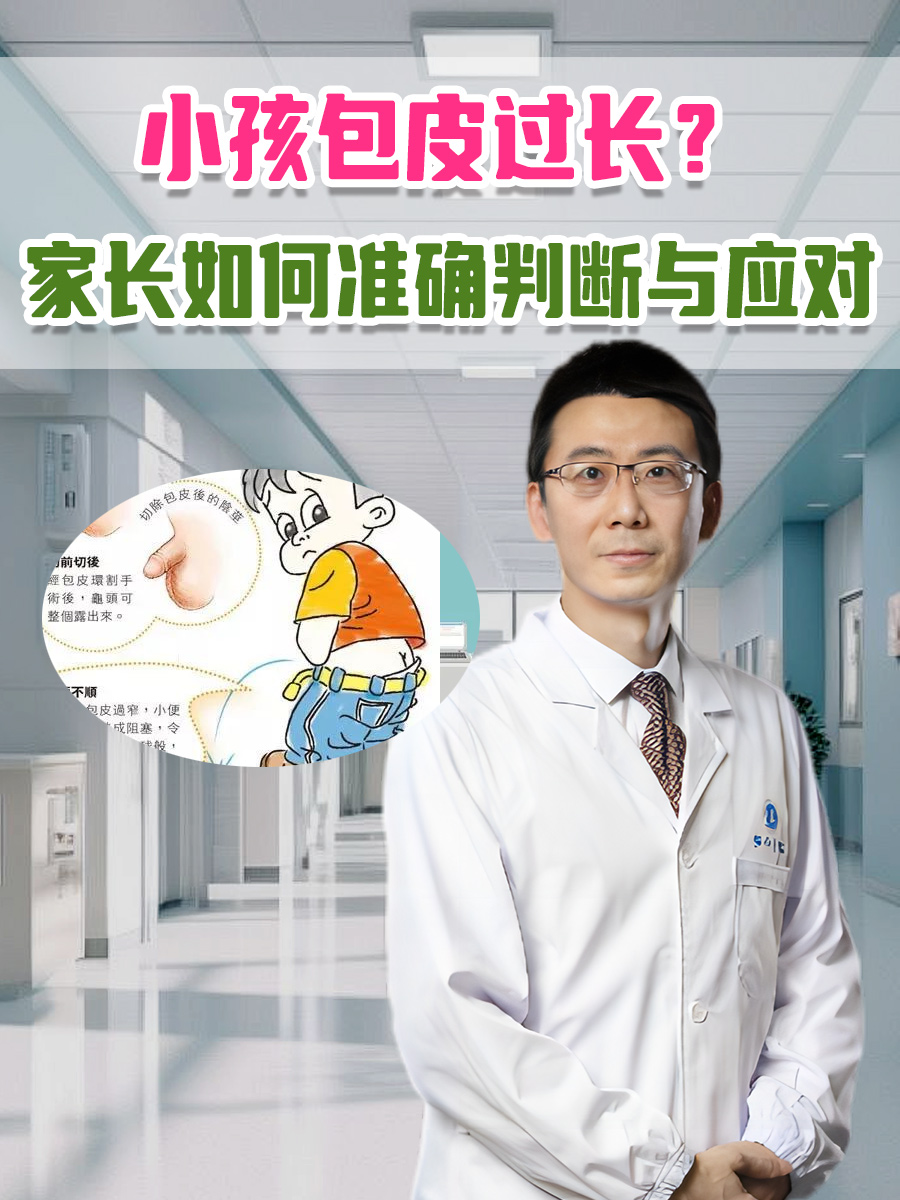 小孩包皮过长?家长如何准确判断与应对