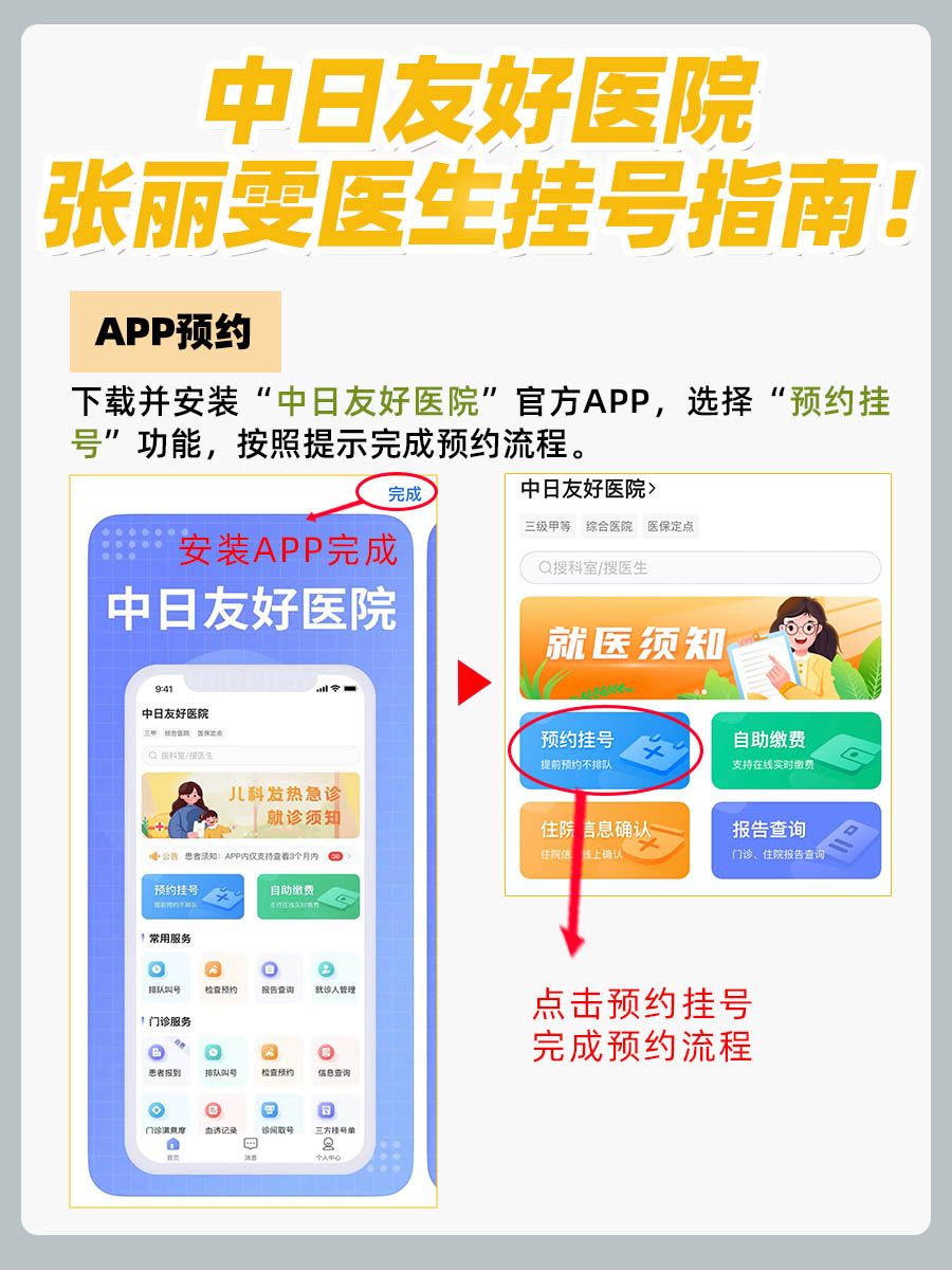 中日友好医院张丽雯医生怎么样？怎么挂号？