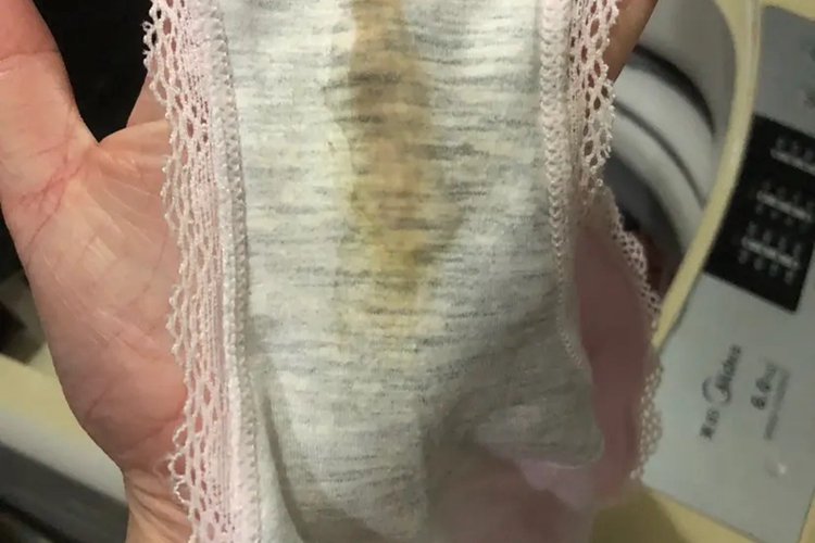 先兆流产分泌物图 先兆流产分泌物图