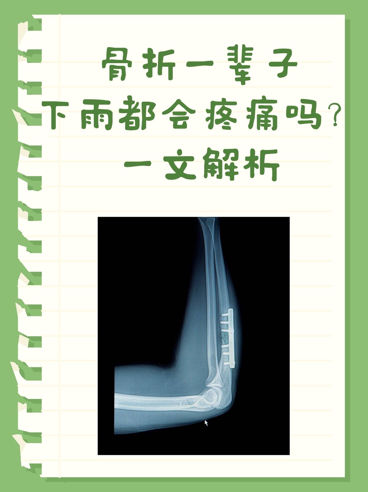 骨折一辈子下雨都会疼痛吗？一文解析