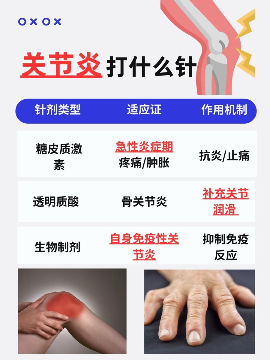 带你了解：关节炎的打什么针？