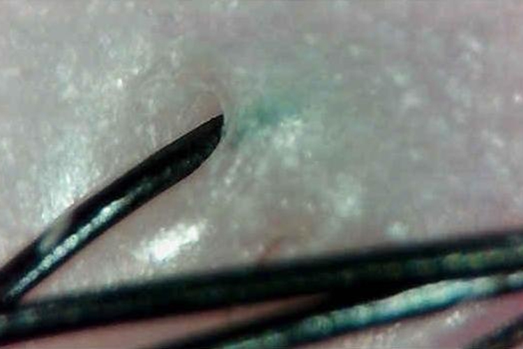 健康头皮毛囊图