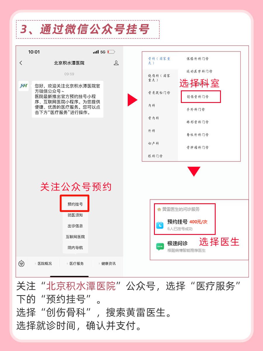北京积水潭医院黄雷医生怎么样?怎么挂号?