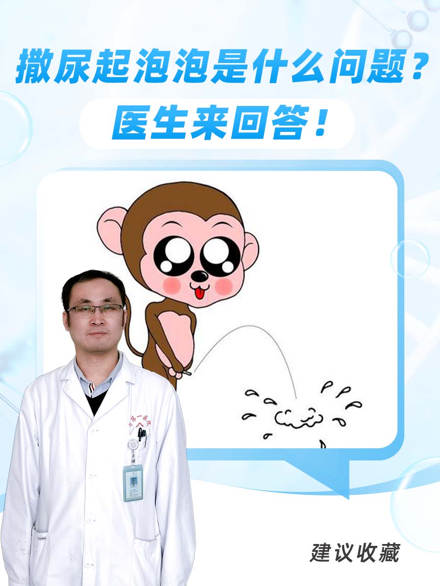 撒尿起泡泡是什么问题？医生来回答！