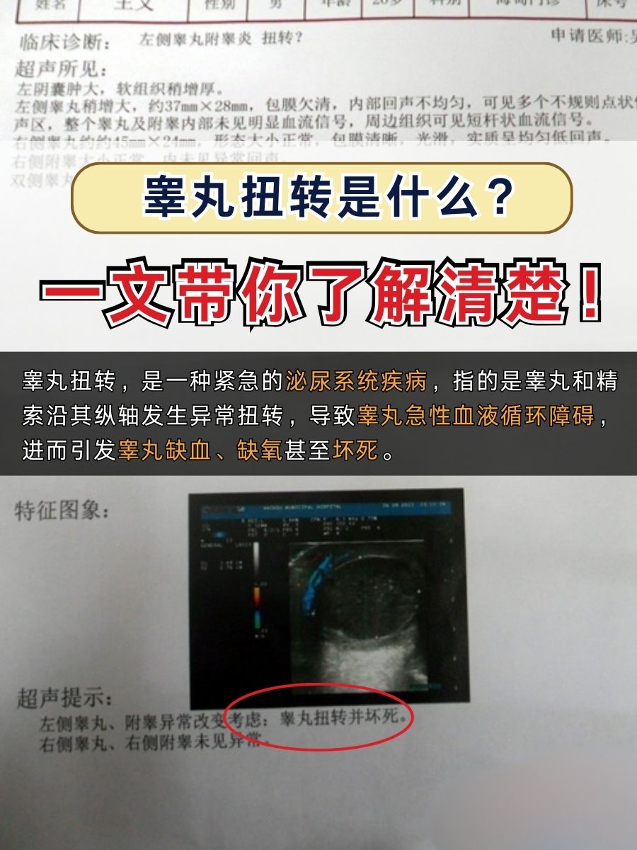 睾丸扭转是什么？一文带你了解清楚！