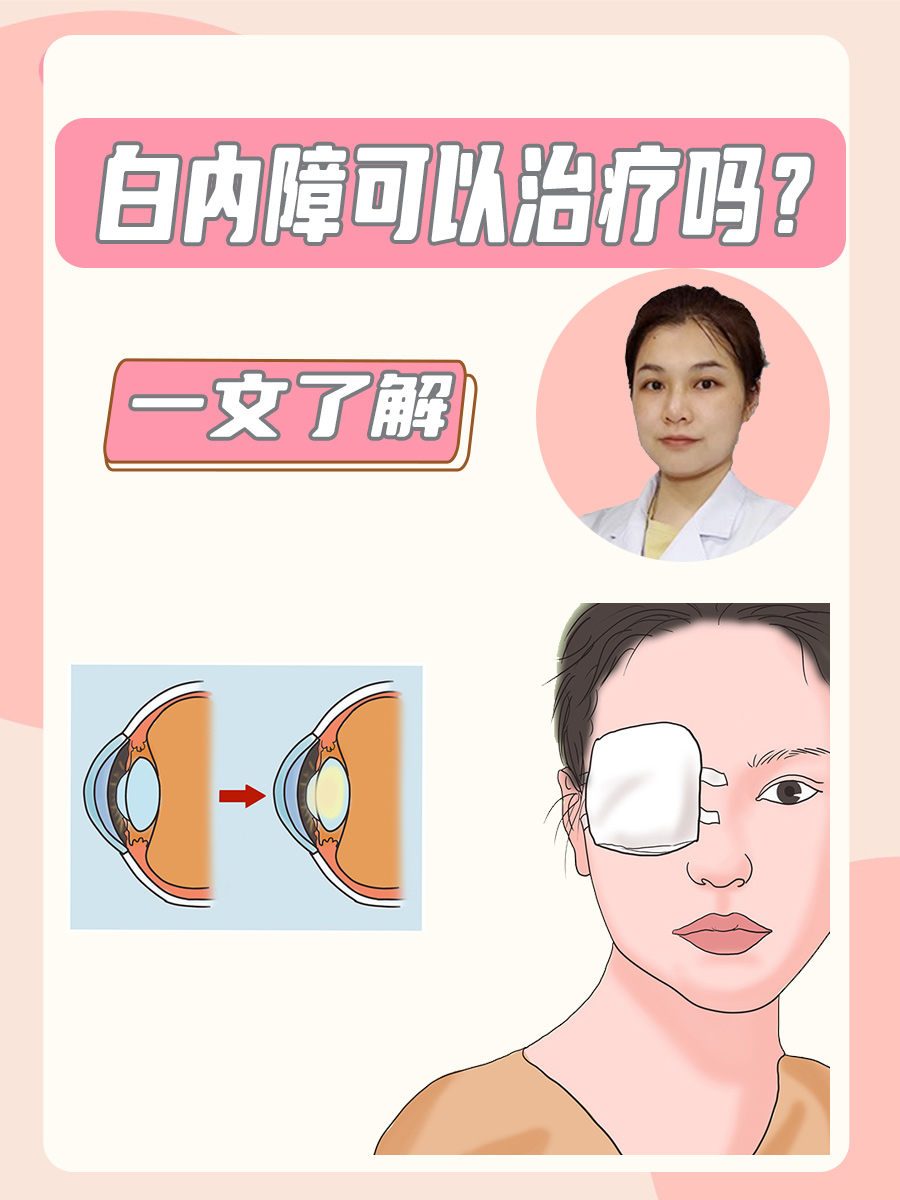 白内障可以治疗吗？一文了解