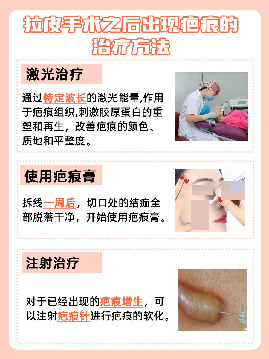 拉皮手术之后多久用疤痕膏，医生带你解密