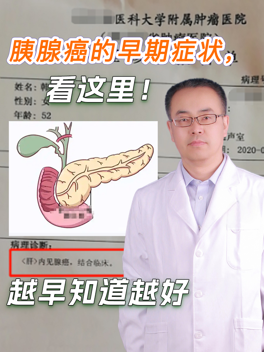 胰腺癌的早期症状,看这里!越早知道越好
