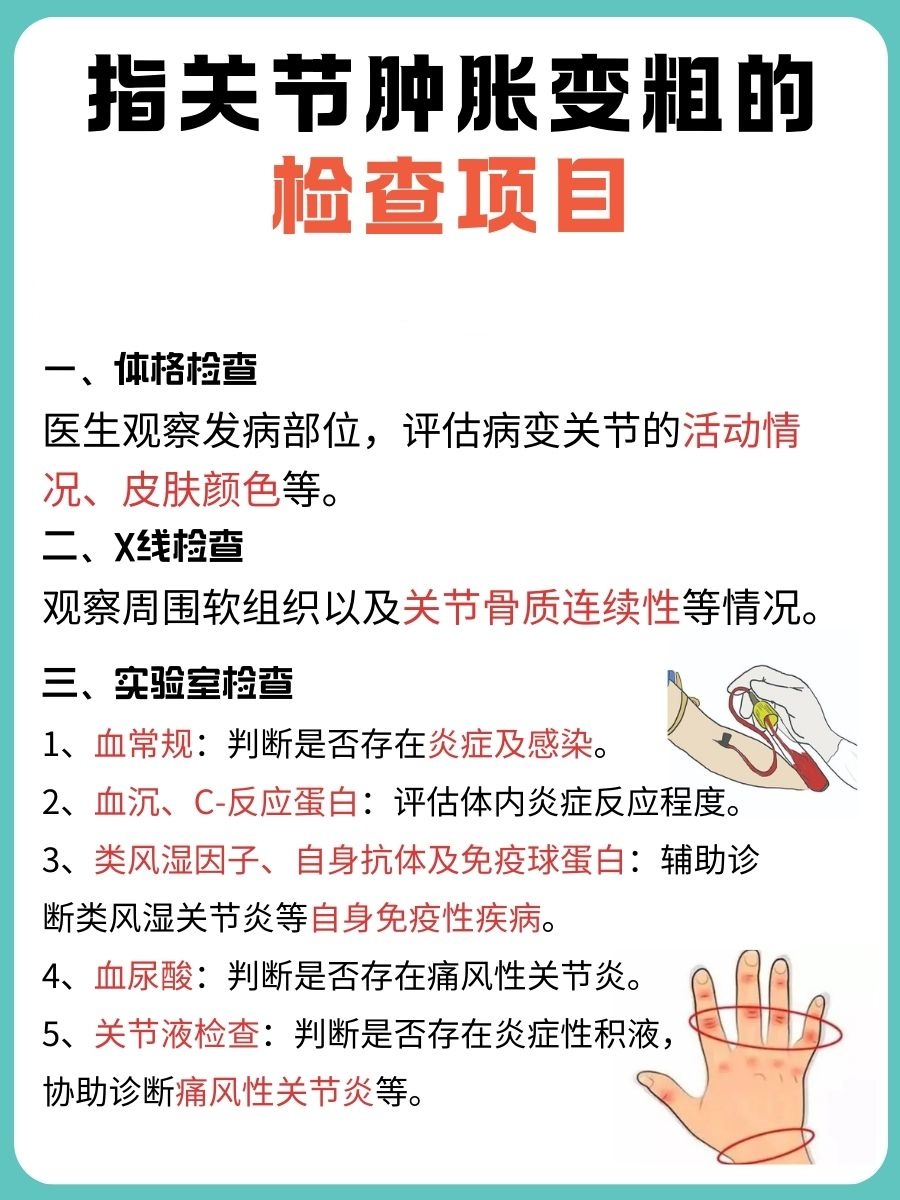 指关节肿胀变粗，精准病因处理是关键