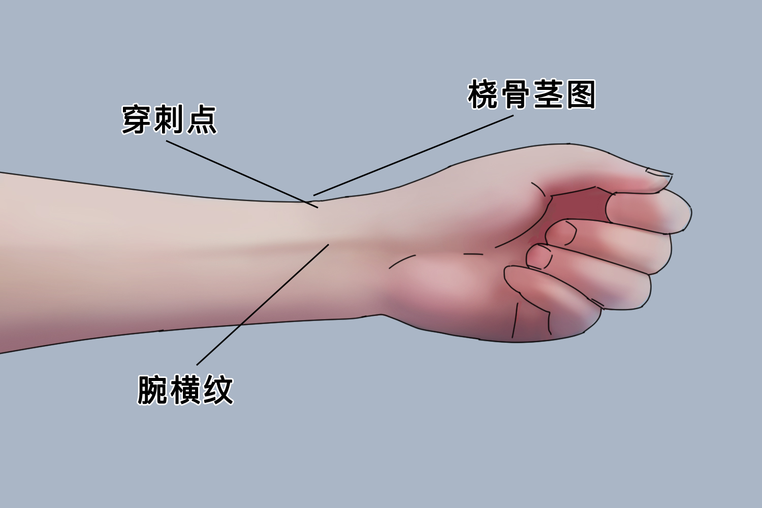 桡动脉穿刺角度图片