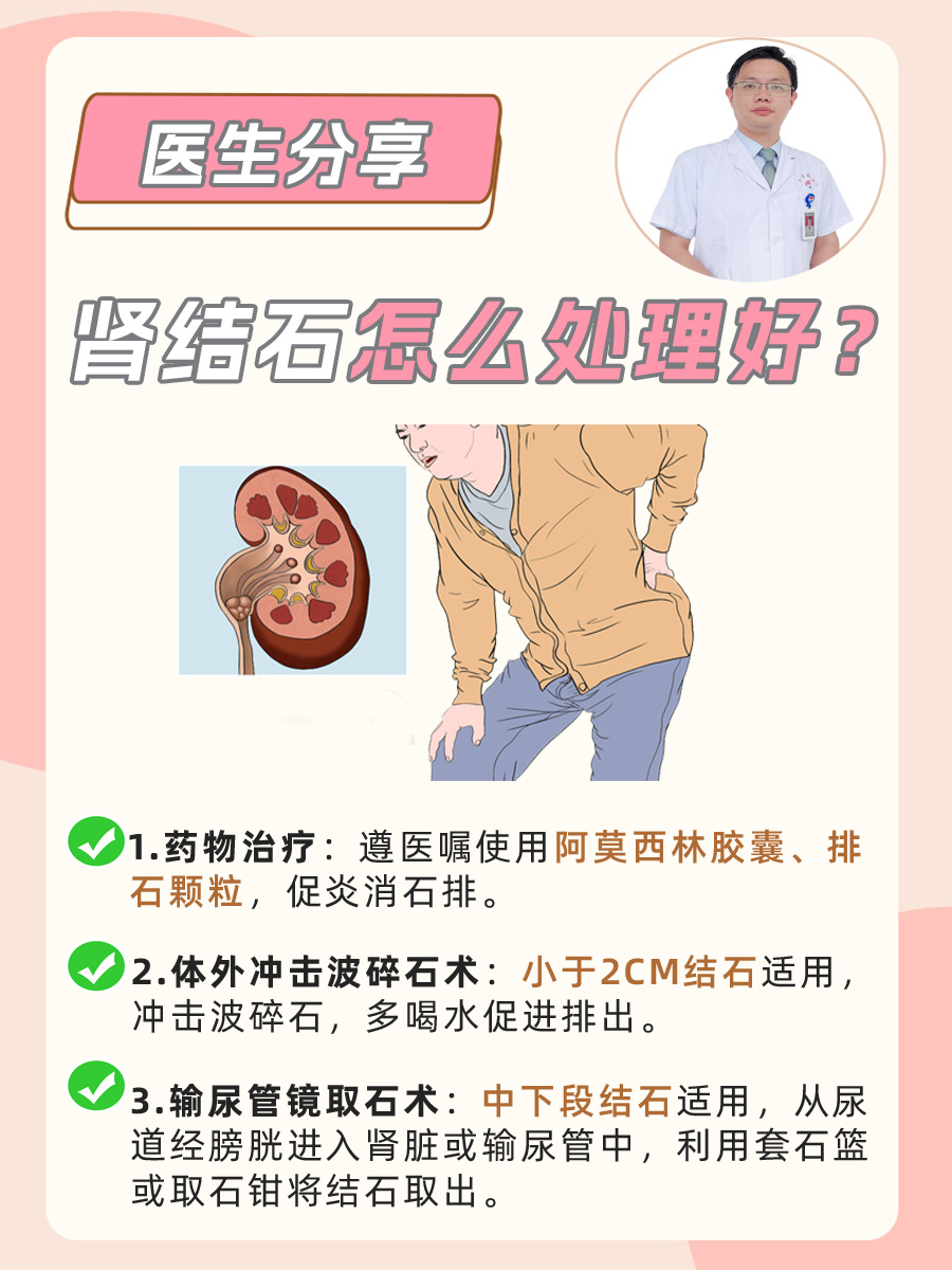 医生分享：肾结石怎么处理好？