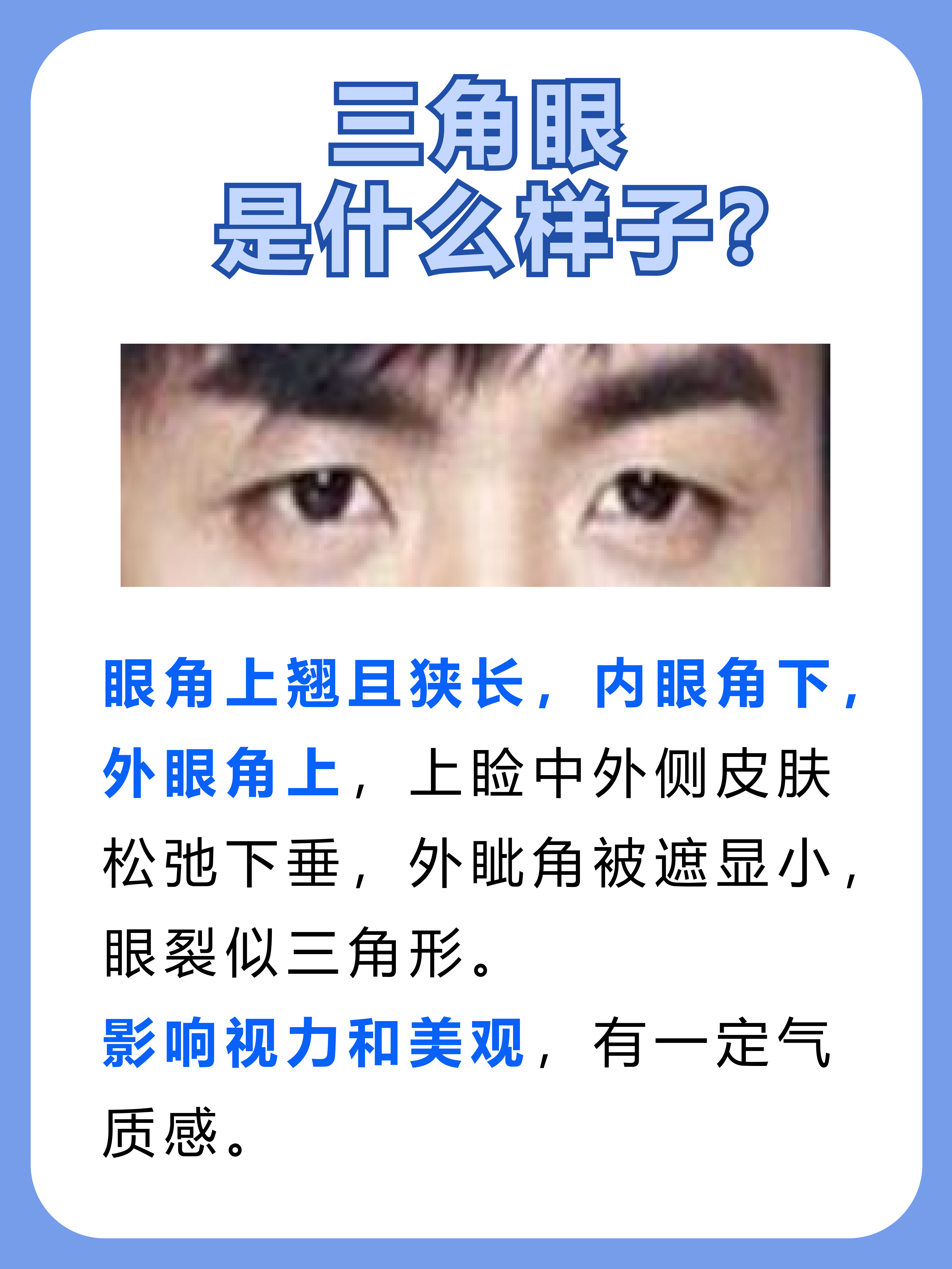 三角眼是什么样子图片