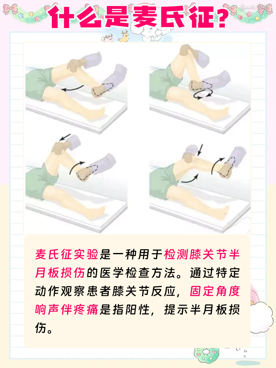 你是否知道:麦氏征试验是什么?