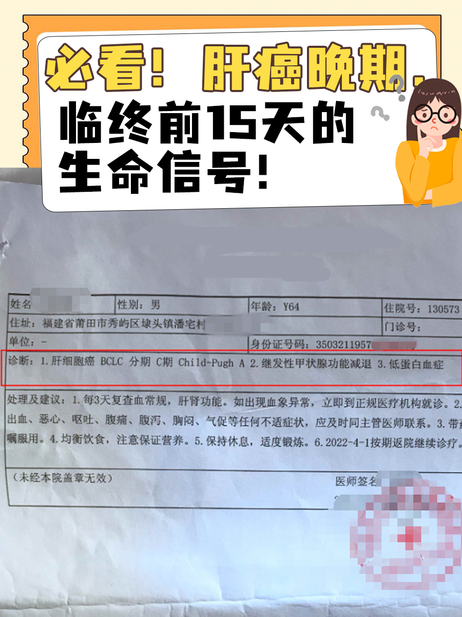 必看！肝癌晚期，临终前15天的生命信号！