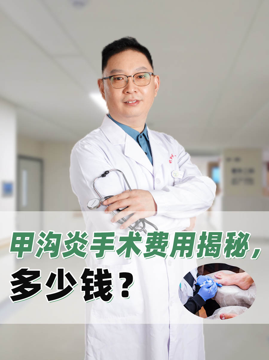 甲沟炎手术费用揭秘，多少钱？