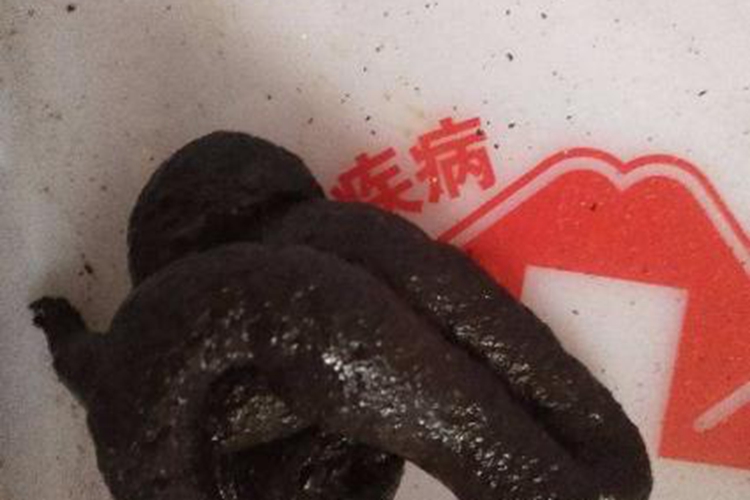 正常大便发黑图