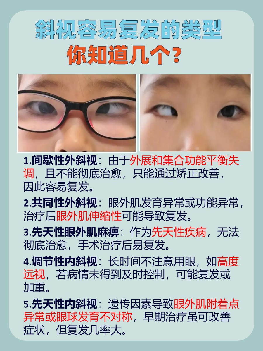 警惕！这些斜视类型易复发，你中招了吗？
