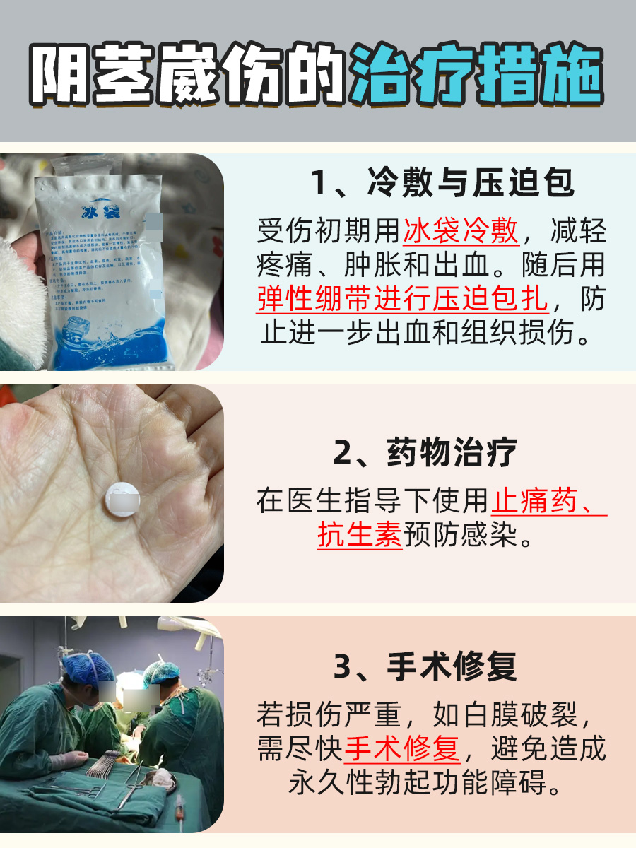 房事意外!阴茎崴伤后,勃起功能何时能恢复?