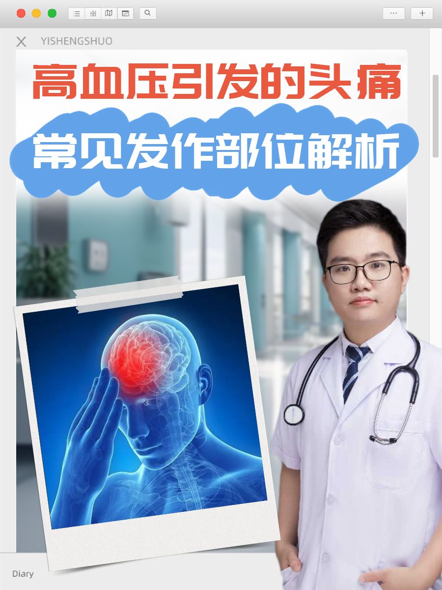 高血压引发的头痛：常见发作部位解析。