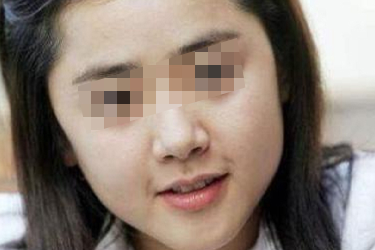 婴儿肥面部外观图