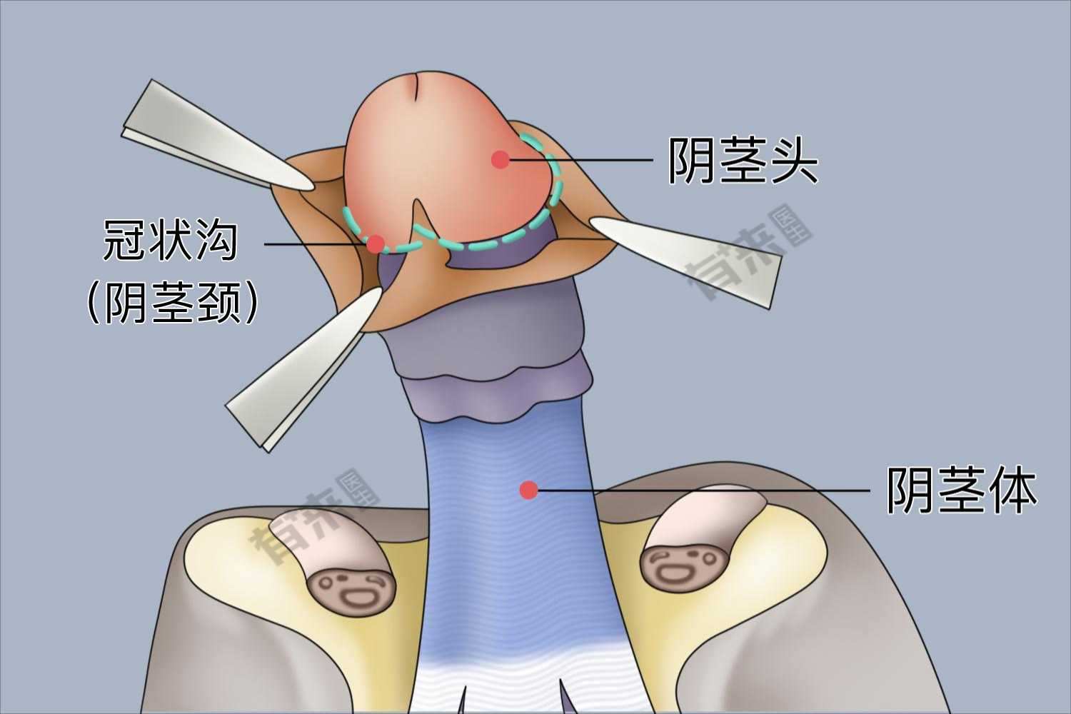 在阴茎勃起后,包皮组织会回缩到冠状沟部位,充分显露龟头组织