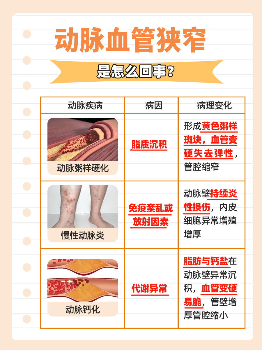 探究！动脉血管狭窄是怎么回事？