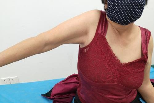 肩周炎活动受限图